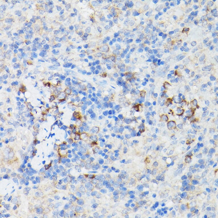 Immunohistochemistry - Anti-Interferon alpha/beta receptor 1 Antibody (A308248) - Antibodies.com