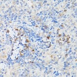 Immunohistochemistry - Anti-Interferon alpha/beta receptor 1 Antibody (A308248) - Antibodies.com