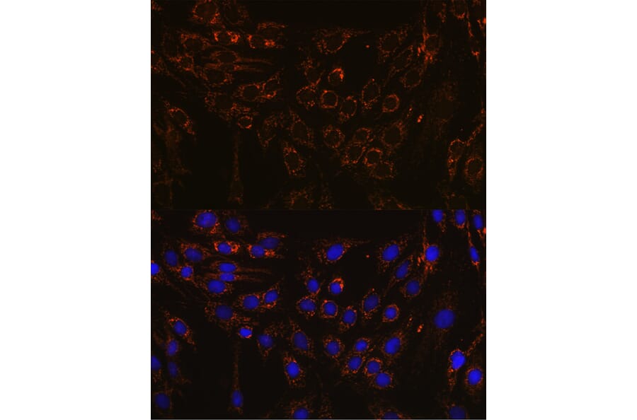 Immunofluorescence - Anti-Interferon alpha/beta receptor 1 Antibody (A308248) - Antibodies.com