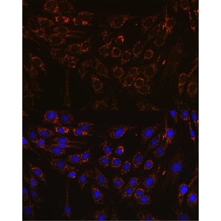 Immunofluorescence - Anti-Interferon alpha/beta receptor 1 Antibody (A308248) - Antibodies.com