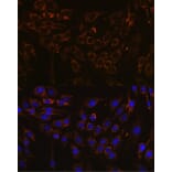 Immunofluorescence - Anti-Interferon alpha/beta receptor 1 Antibody (A308248) - Antibodies.com