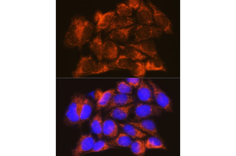 Immunofluorescence - Anti-Interferon alpha/beta receptor 1 Antibody (A308248) - Antibodies.com