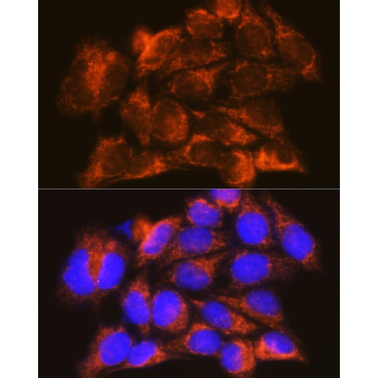 Immunofluorescence - Anti-Interferon alpha/beta receptor 1 Antibody (A308248) - Antibodies.com