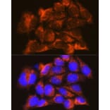 Immunofluorescence - Anti-Interferon alpha/beta receptor 1 Antibody (A308248) - Antibodies.com
