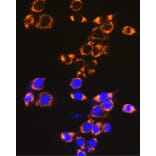 Immunofluorescence - Anti-Interferon alpha/beta receptor 1 Antibody (A308248) - Antibodies.com