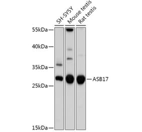 Western Blot - Anti-ASB17 Antibody (A308249) - Antibodies.com