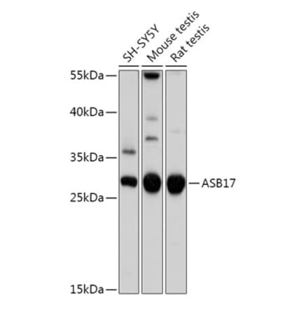 Western Blot - Anti-ASB17 Antibody (A308249) - Antibodies.com