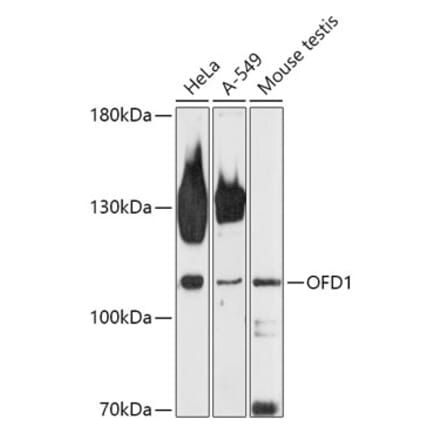 Western Blot - Anti-OFD1 Antibody (A308250) - Antibodies.com