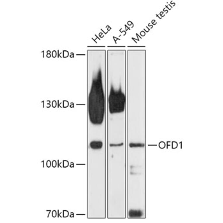Western Blot - Anti-OFD1 Antibody (A308250) - Antibodies.com