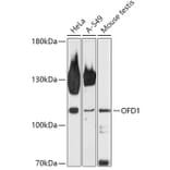 Western Blot - Anti-OFD1 Antibody (A308250) - Antibodies.com