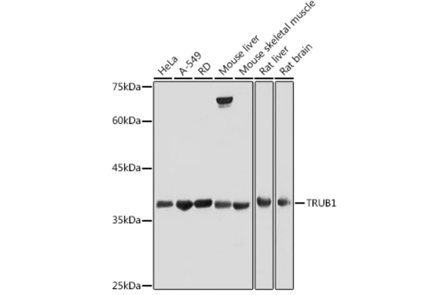 Western Blot - Anti-TRUB1 Antibody (A308251) - Antibodies.com