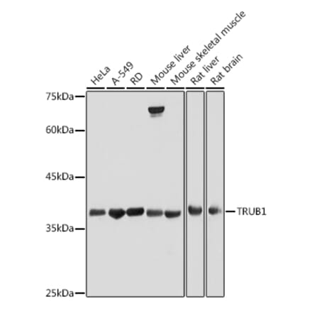 Western Blot - Anti-TRUB1 Antibody (A308251) - Antibodies.com