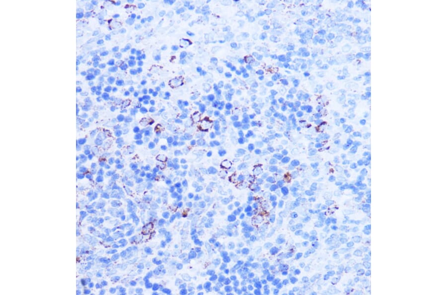 Immunohistochemistry - Anti-SHMT2/SHMT Antibody (A308252) - Antibodies.com