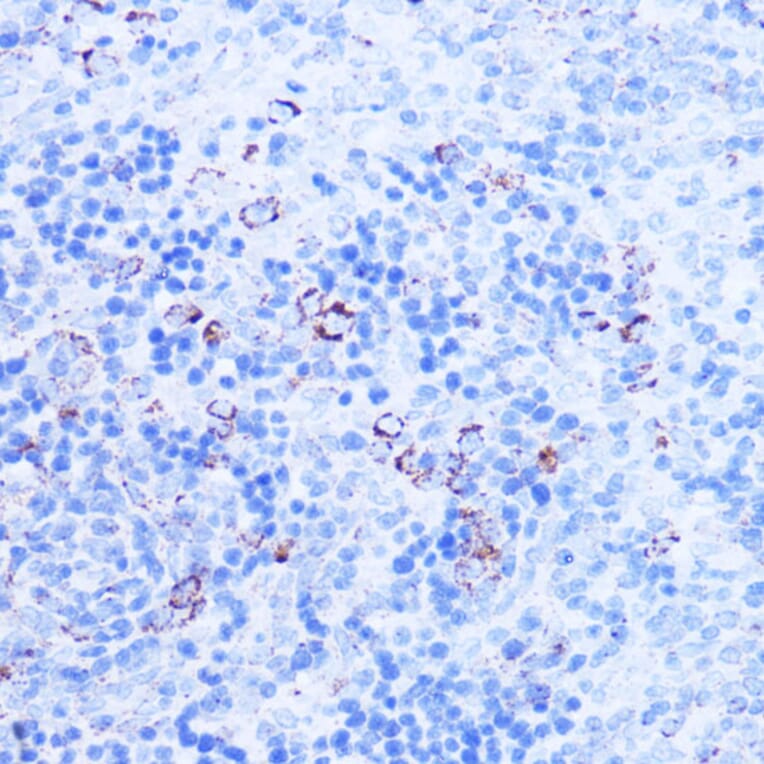 Immunohistochemistry - Anti-SHMT2/SHMT Antibody (A308252) - Antibodies.com