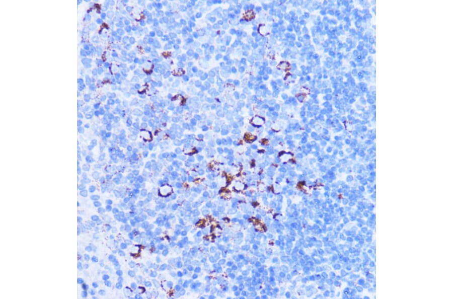 Immunohistochemistry - Anti-SHMT2/SHMT Antibody (A308252) - Antibodies.com