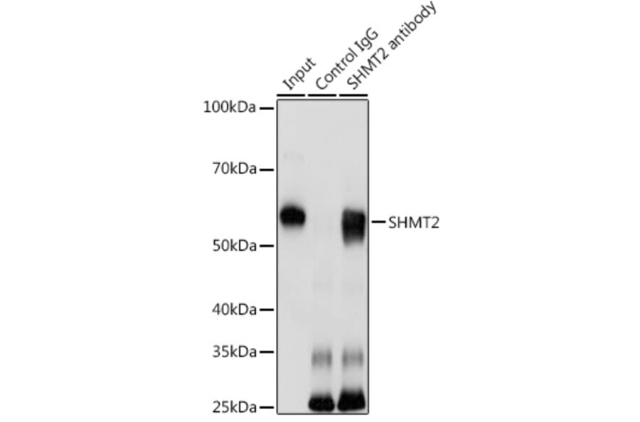 Western Blot - Anti-SHMT2/SHMT Antibody (A308252) - Antibodies.com