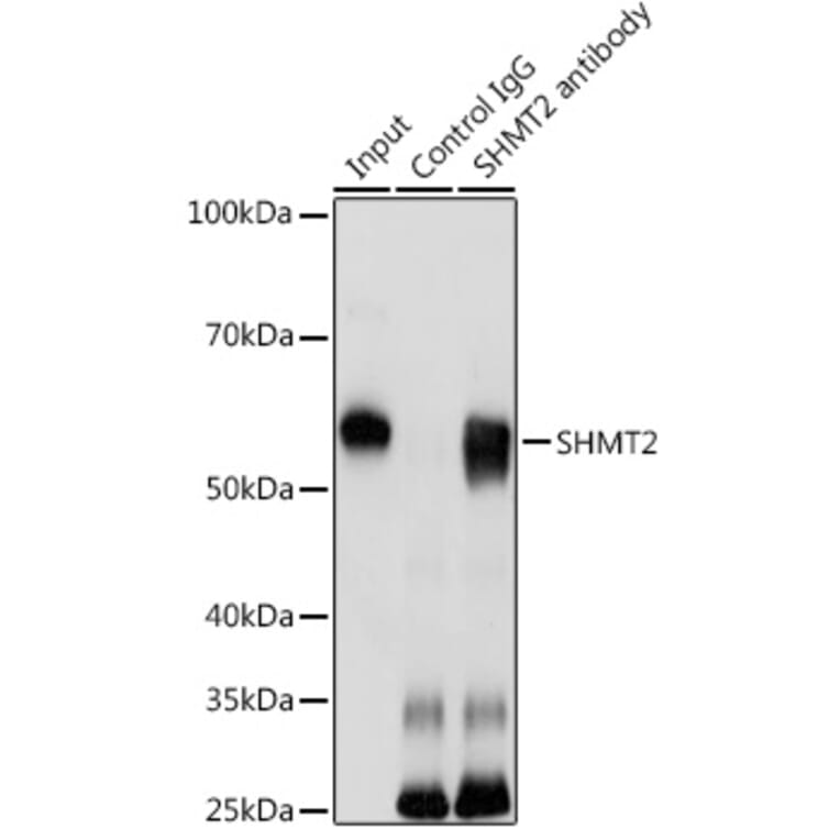 Western Blot - Anti-SHMT2/SHMT Antibody (A308252) - Antibodies.com