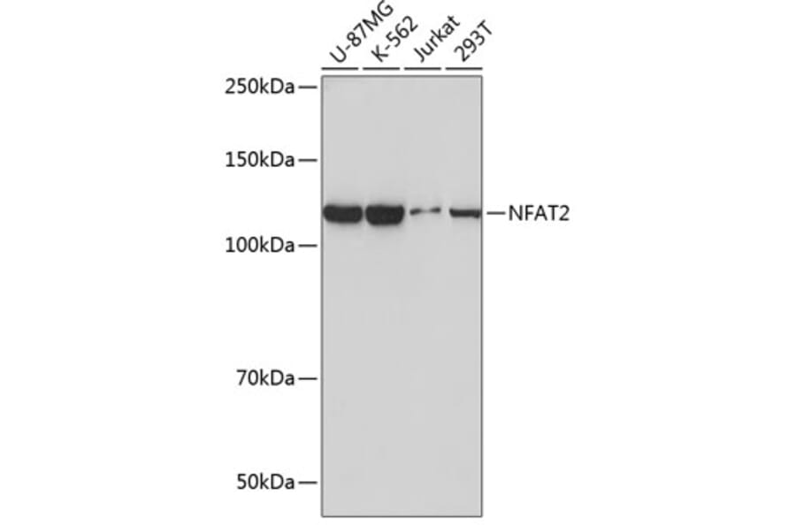 Western Blot - Anti-NFAT2 Antibody [ARC0076] (A308253) - Antibodies.com