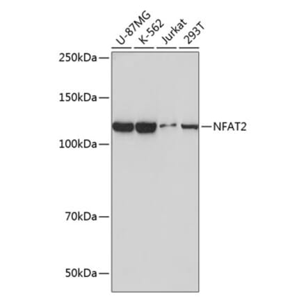 Western Blot - Anti-NFAT2 Antibody [ARC0076] (A308253) - Antibodies.com