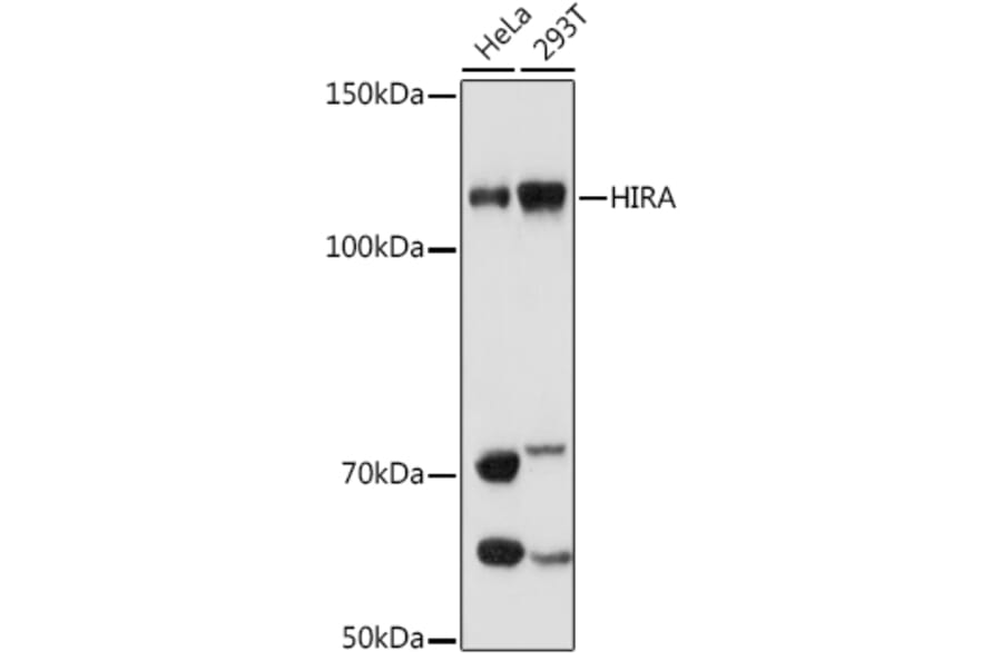 Western Blot - Anti-HIRA/HIR Antibody [ARC1341] (A308255) - Antibodies.com