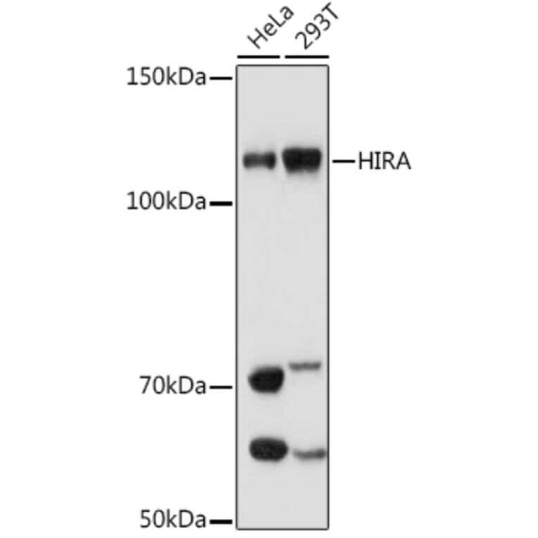 Western Blot - Anti-HIRA/HIR Antibody [ARC1341] (A308255) - Antibodies.com