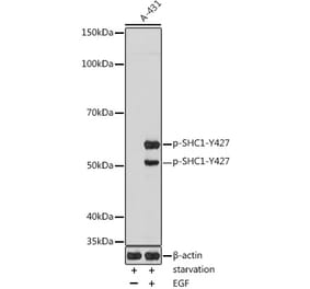 Western Blot - Anti-SHC (phospho Tyr427) Antibody (A308256) - Antibodies.com