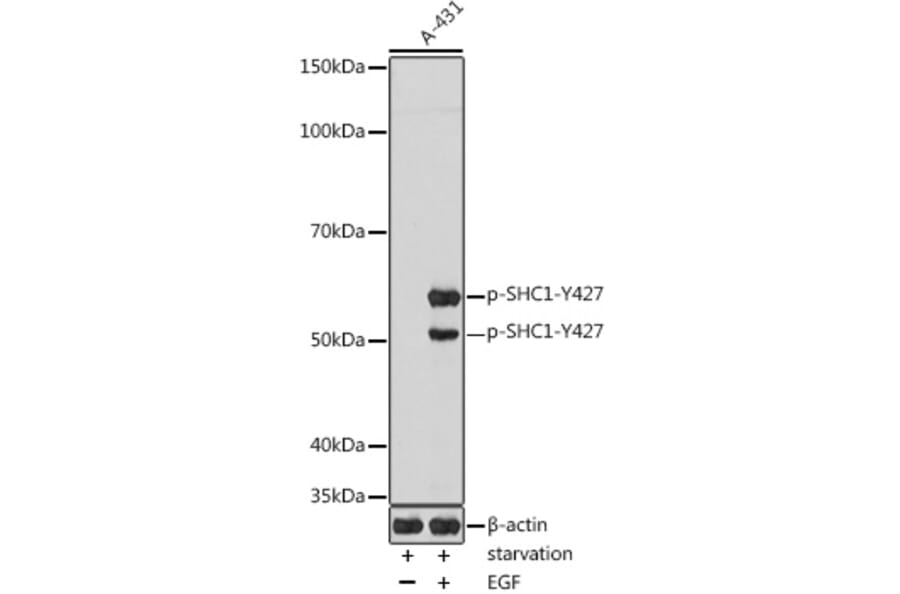 Western Blot - Anti-SHC (phospho Tyr427) Antibody (A308256) - Antibodies.com