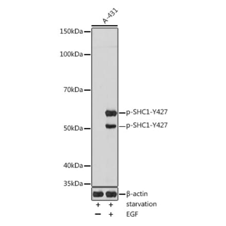 Western Blot - Anti-SHC (phospho Tyr427) Antibody (A308256) - Antibodies.com