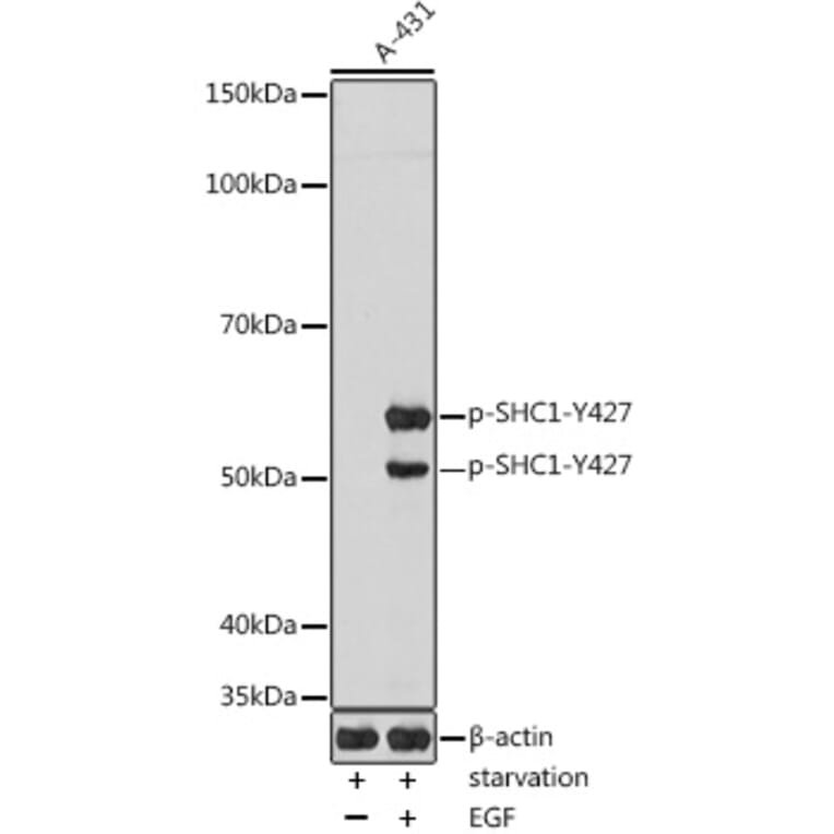 Western Blot - Anti-SHC (phospho Tyr427) Antibody (A308256) - Antibodies.com