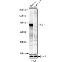 Western Blot - Anti-YAP1 Antibody (A308257) - Antibodies.com