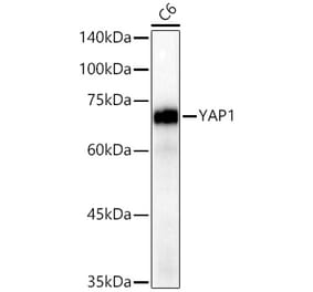 Western Blot - Anti-YAP1 Antibody [ARC53477] (A308258) - Antibodies.com