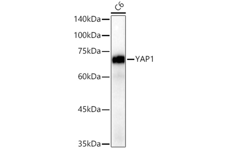 Western Blot - Anti-YAP1 Antibody [ARC53477] (A308258) - Antibodies.com