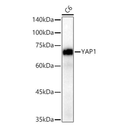 Western Blot - Anti-YAP1 Antibody [ARC53477] (A308258) - Antibodies.com