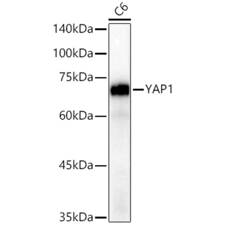 Western Blot - Anti-YAP1 Antibody [ARC53477] (A308258) - Antibodies.com