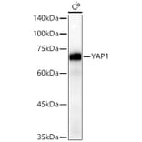 Western Blot - Anti-YAP1 Antibody [ARC53477] (A308258) - Antibodies.com