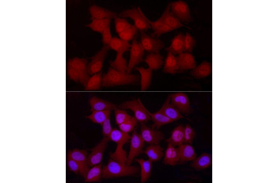 Immunofluorescence - Anti-YAP1 Antibody [ARC53477] (A308258) - Antibodies.com
