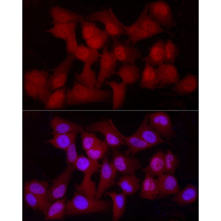 Immunofluorescence - Anti-YAP1 Antibody [ARC53477] (A308258) - Antibodies.com