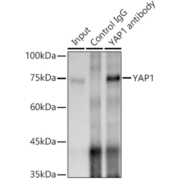 Western Blot - Anti-YAP1 Antibody [ARC53477] (A308258) - Antibodies.com