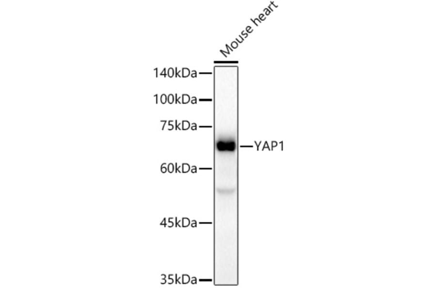 Western Blot - Anti-YAP1 Antibody [ARC53477] (A308258) - Antibodies.com
