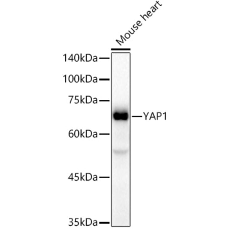 Western Blot - Anti-YAP1 Antibody [ARC53477] (A308258) - Antibodies.com