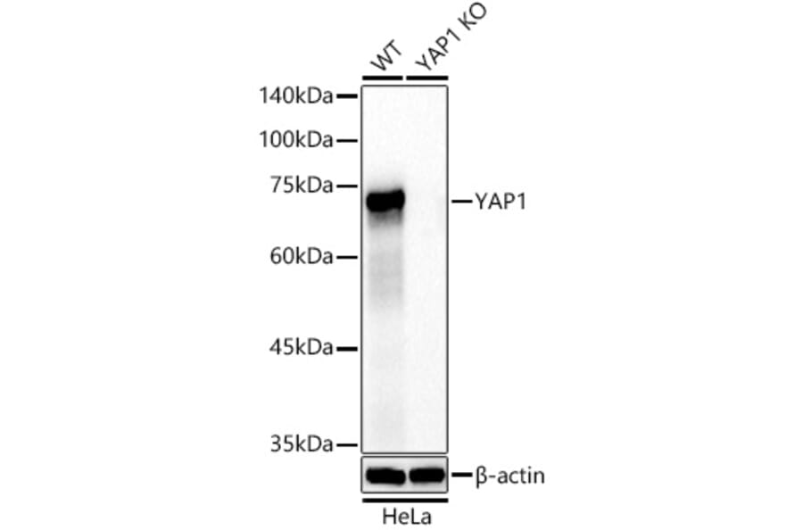 Western Blot - Anti-YAP1 Antibody [ARC53477] (A308258) - Antibodies.com