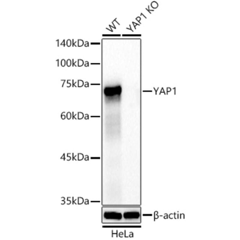 Western Blot - Anti-YAP1 Antibody [ARC53477] (A308258) - Antibodies.com