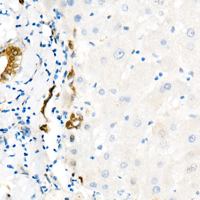 Immunohistochemistry - Anti-YAP1 Antibody [ARC53477] (A308258) - Antibodies.com