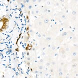 Immunohistochemistry - Anti-YAP1 Antibody [ARC53477] (A308258) - Antibodies.com