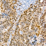 Immunohistochemistry - Anti-YAP1 Antibody [ARC53477] (A308258) - Antibodies.com