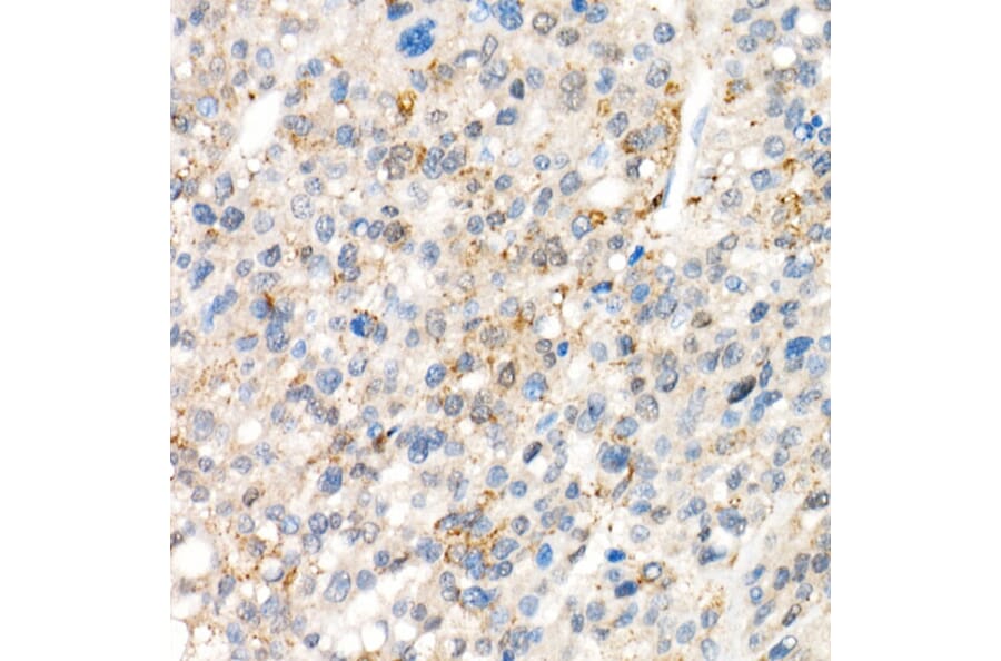 Immunohistochemistry - Anti-YAP1 Antibody [ARC53477] (A308258) - Antibodies.com