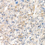 Immunohistochemistry - Anti-YAP1 Antibody [ARC53477] (A308258) - Antibodies.com