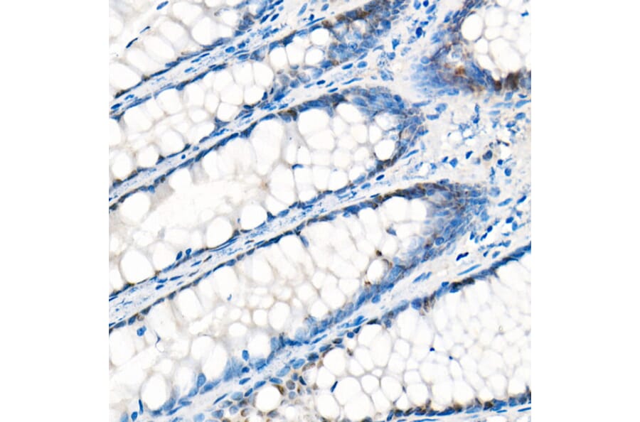 Immunohistochemistry - Anti-YAP1 Antibody [ARC53477] (A308258) - Antibodies.com