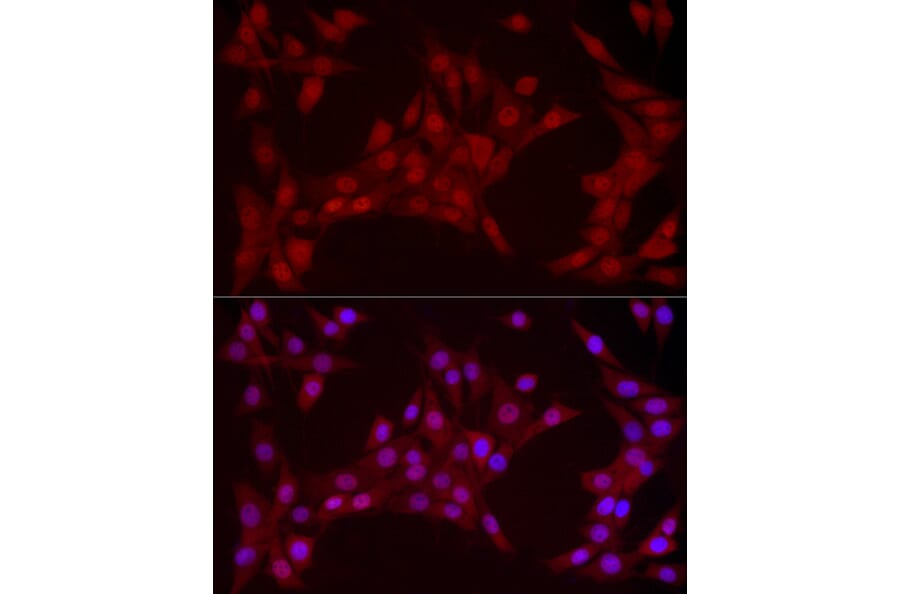 Immunofluorescence - Anti-YAP1 Antibody [ARC53477] (A308258) - Antibodies.com