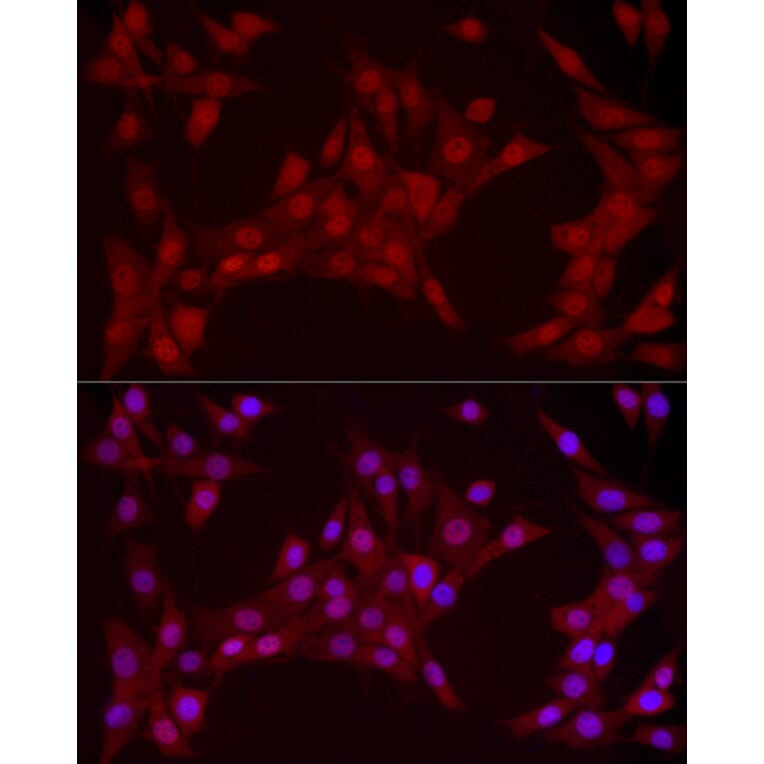 Immunofluorescence - Anti-YAP1 Antibody [ARC53477] (A308258) - Antibodies.com